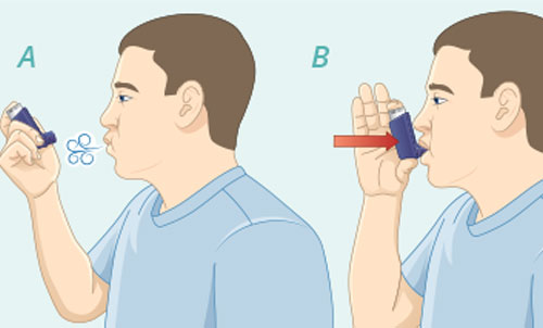 Split image – Left side is someone exhaling as much as they can; right side is putting it in your mouth Push as much air from your lungs as you can