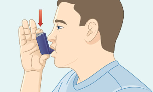Illustration of someone with inhaler to their lips and an arrow showing them pressing down on the canister Push down and breathe in